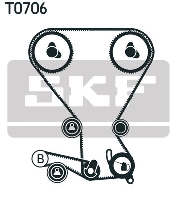 Timing Belt Kit-1